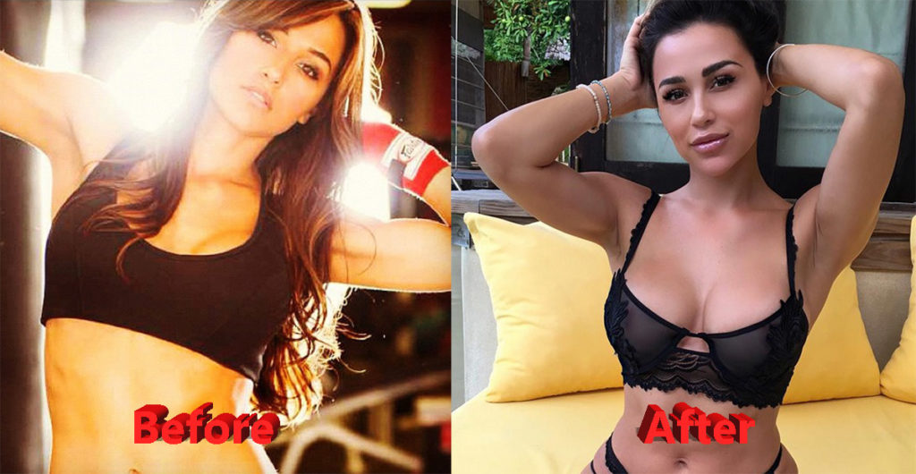 Before after cheri ana and Ana Cheri